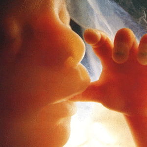 33665_foetus.gif