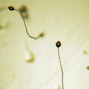 408px-dictyostelium_fruiting_bodies.jpg