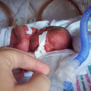450px-premature_infant_with_ventilator.jpg