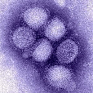 509px-H1N1_influenza_virus.jpg