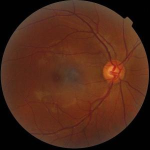 590px-retinography.jpg