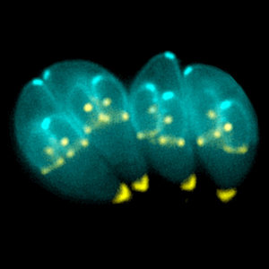 600px-toxoplasma_gondii.jpg