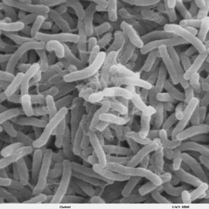 614px-cholera_bacteria_sem.jpg