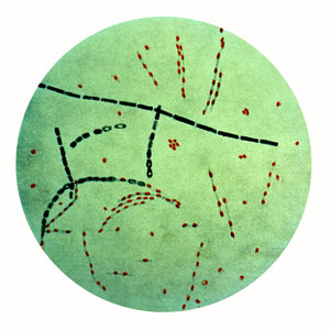 654px-bacillus_anthracis.jpg