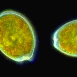 67852035-arsenic-bacteria.jpg