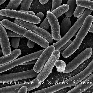 713px-escherichiacoli_niaid.jpg