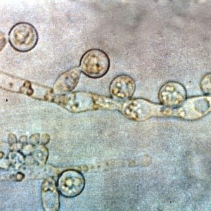 800px-candida_albicans_2.jpg