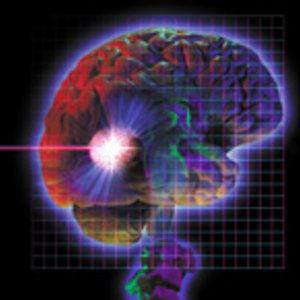 DT_brainactivity_ok.jpg