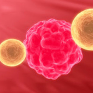 DT_cancercell-2_ok.jpg