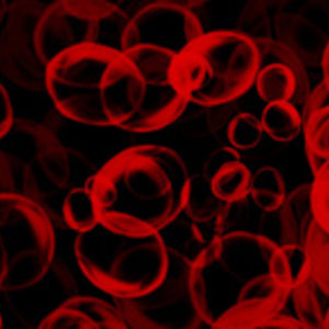 DT_cells_ok.jpg