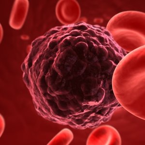 DT_tumorcell.jpg
