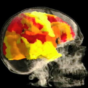 an-image-of-the-brain-of--008.jpg