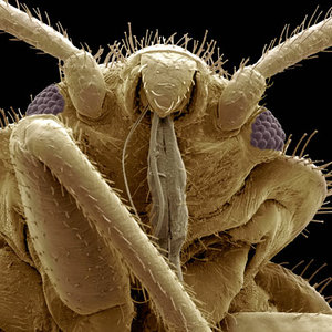 bedbug_1592350i.jpg