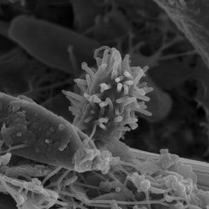 biofilm_sur_un_grain_de_sable_-_bacteries.jpg