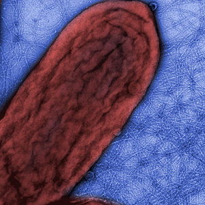 biological-nanowireszoom.jpg