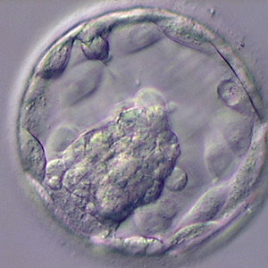 blastocysts.jpg