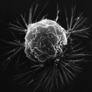 cellule_cancereuse_nih-nationalcancerinstitute.gif