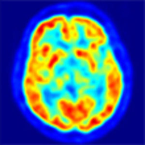 cerveau-couleur.jpg