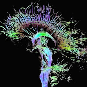 cerveau-humain.jpg