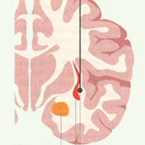 claustrum.jpg