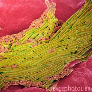 clostridium_difficile_adhere_a_la_surface_de_lintestin.jpg