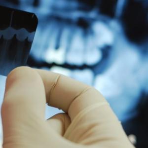 dentiste-radiographie.jpg