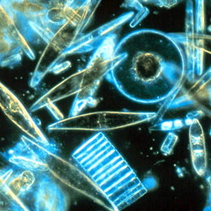 diatoms-phytoplankton-photo34.jpg