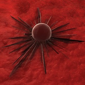 dt_cancercell.jpg