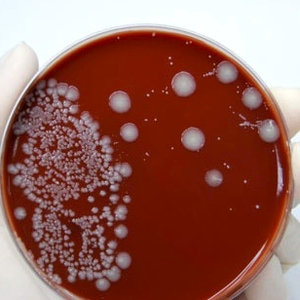 e-coli.jpg