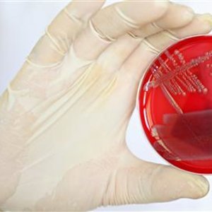 e._coli_enterohemorragique.jpg