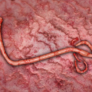 ebola-dreamstime_xs_46056907.jpg