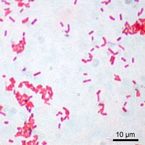 escherichia_coli_gram.jpg