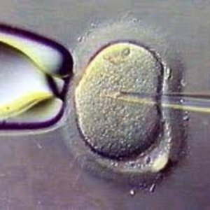 fecondation_in_vitro.jpg