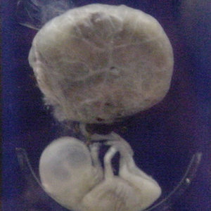 fetus_3_months.jpg