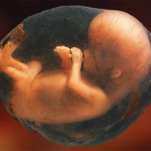 fetus_amniotic_sac.jpg