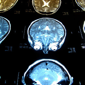 flickr_imbrains.jpg