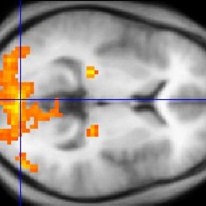 fmri.jpg