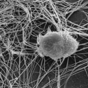 follicular_dendritic_cell.jpg