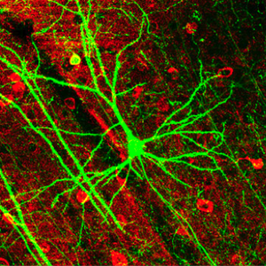gfpneuron.png