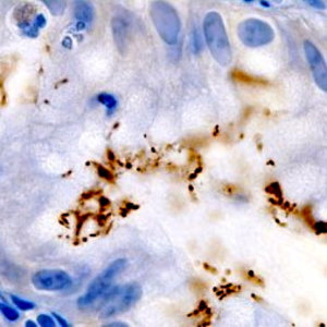 helicobacter-pylori.jpg