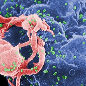 hiv.jpg