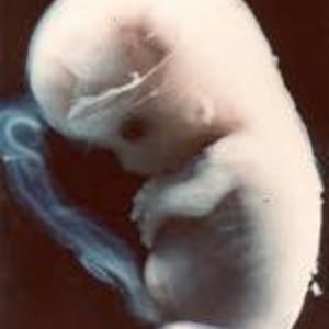 images_foetus.jpg