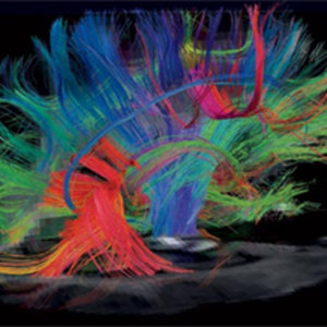 irm-diffusion.jpg