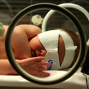 jaundice_phototherapy.jpg