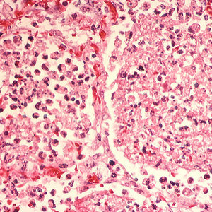 legionella.jpg