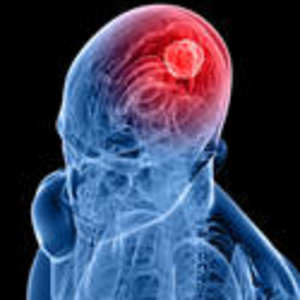 lesion_cerveau.jpg