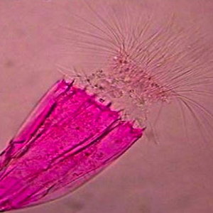 loricifera.jpg