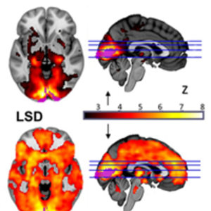 lsd.jpg