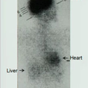 metabolisme.jpg