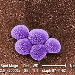 mrsa_sem_9994_lores.jpg